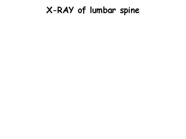 X-RAY of lumbar spine 