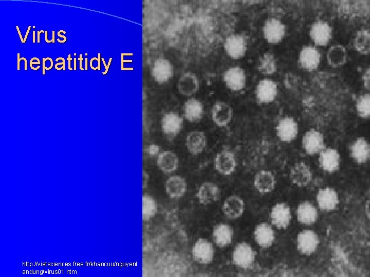 Virus hepatitidy E http: //vietsciences. free. fr/khaocuu/nguyenl andung/virus 01. htm 