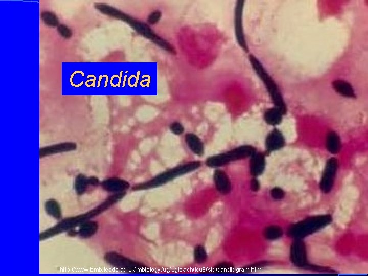 Candida http: //www. bmb. leeds. ac. uk/mbiology/ug/ugteach/icu 8/std/candidgram. html 