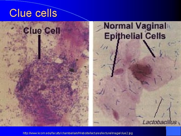 Clue cells http: //www. kcom. edu/faculty/chamberlain/Website/lectures/lecture/image/clue 2. jpg 