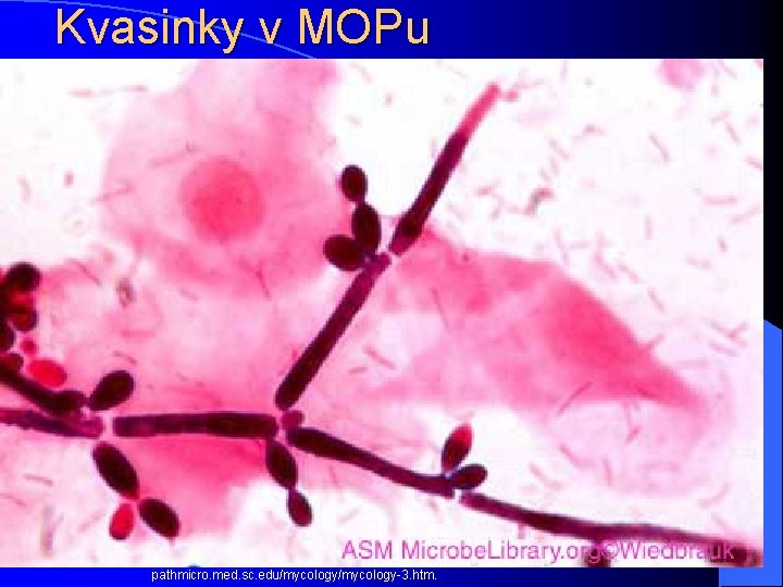 Kvasinky v MOPu pathmicro. med. sc. edu/mycology-3. htm. 