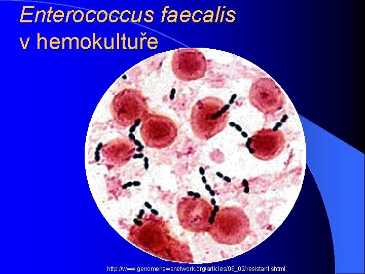 Enterococcus faecalis v hemokultuře http: //www. genomenewsnetwork. org/articles/06_02/resistant. shtml 