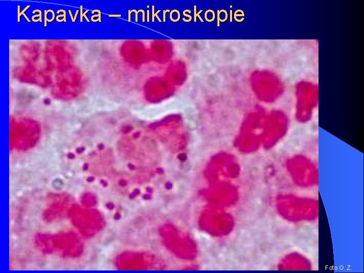 Kapavka – mikroskopie Foto O. Z. 