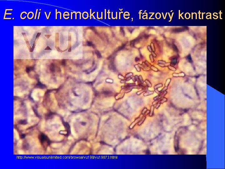 E. coli v hemokultuře, fázový kontrast http: //www. visualsunlimited. com/browse/vu 19873. html 