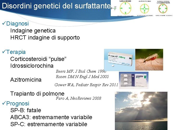 Disordini genetici del surfattante üDiagnosi Indagine genetica HRCT indagine di supporto üTerapia Corticosteroidi “pulse”