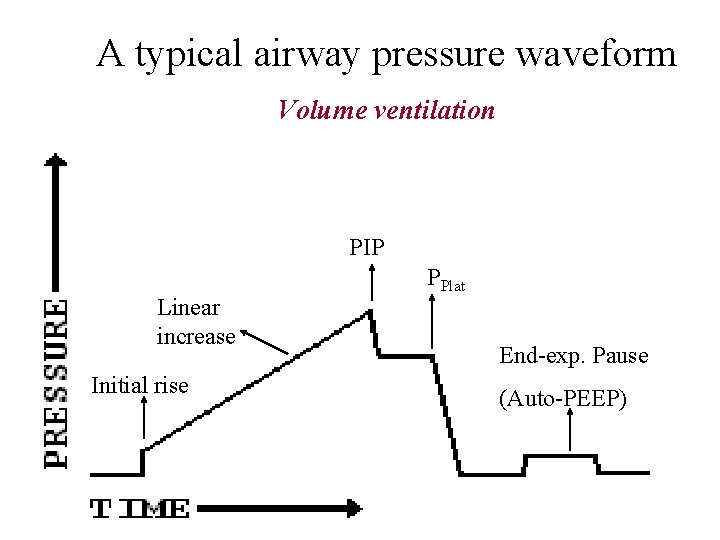 A typical airway pressure waveform Volume ventilation PIP Linear increase Initial rise PPlat End-exp.