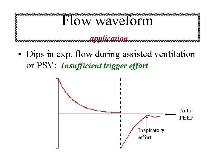 Flow waveform application • Dips in exp. flow during assisted ventilation or PSV: Insufficient