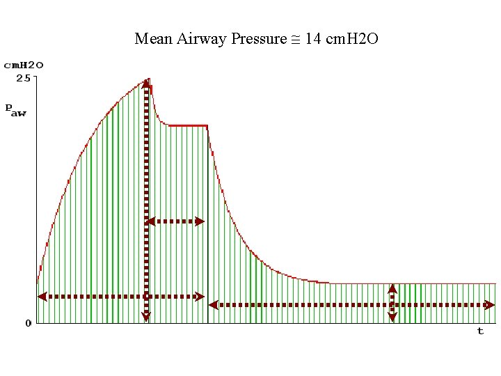 Mean Airway Pressure 14 cm. H 2 O 