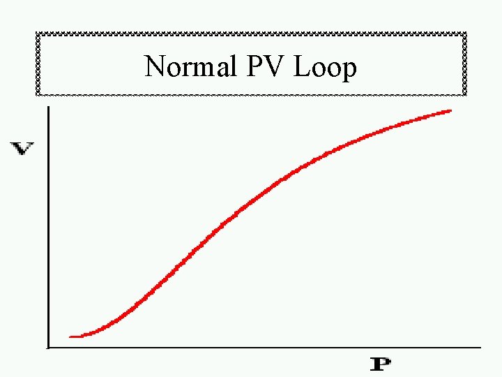 Normal PV Loop 