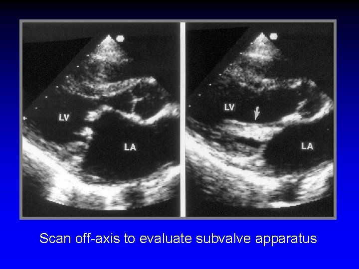 Scan off-axis to evaluate subvalve apparatus 