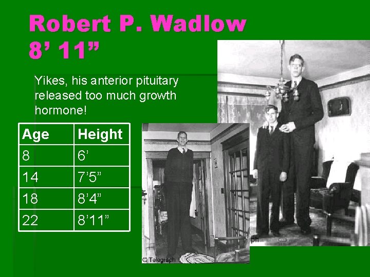 Robert P. Wadlow 8’ 11” Yikes, his anterior pituitary released too much growth hormone! Robert P. Wadlow 8’ 11” Yikes, his anterior pituitary released too much growth hormone!