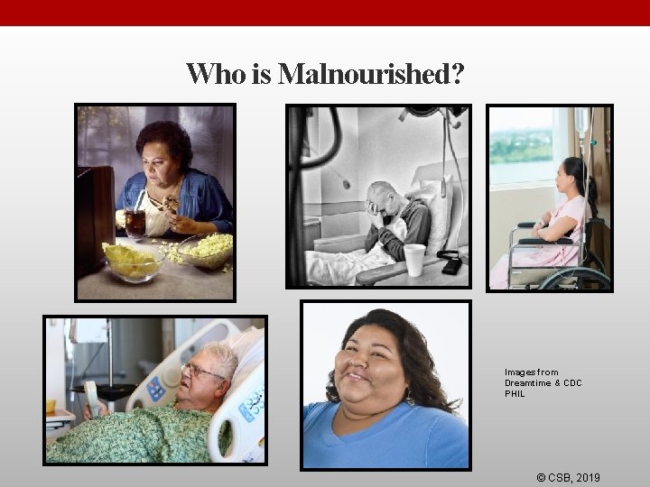 Who is Malnourished? Images from Dreamtime & CDC PHIL © CSB, 2019 