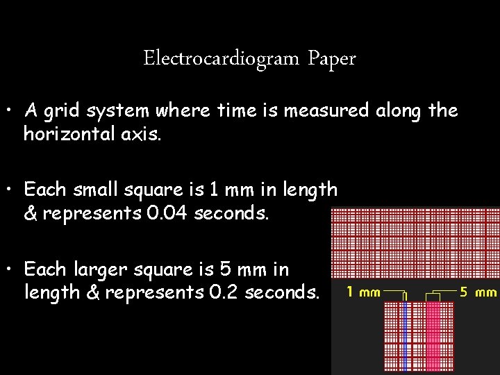 Electrocardiogram Paper • A grid system where time is measured along the horizontal axis. Electrocardiogram Paper • A grid system where time is measured along the horizontal axis.