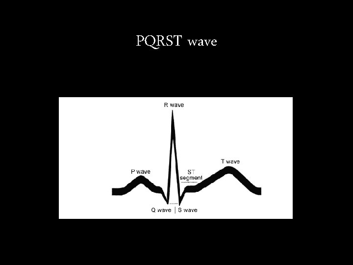 PQRST wave PQRST wave