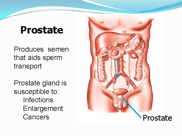 Prostate Produces semen that aids sperm transport Prostate gland is susceptible to: Infections Enlargement Prostate Produces semen that aids sperm transport Prostate gland is susceptible to: Infections Enlargement
