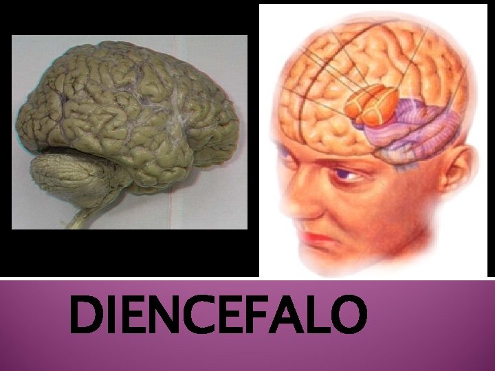 DIENCEFALO 