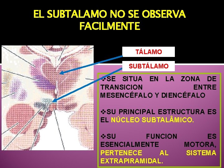 EL SUBTALAMO NO SE OBSERVA FACILMENTE TÁLAMO SUBTÁLAMO v. SE SITUA EN LA ZONA