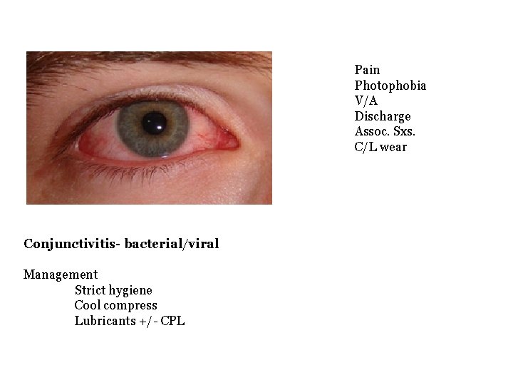 Pain Photophobia V/A Discharge Assoc. Sxs. C/L wear Conjunctivitis- bacterial/viral Management Strict hygiene Cool