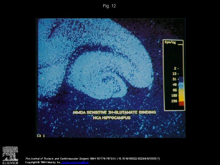 Fig. 12 The Journal of Thoracic and Cardiovascular Surgery 1994 107776 -787 DOI: (10.