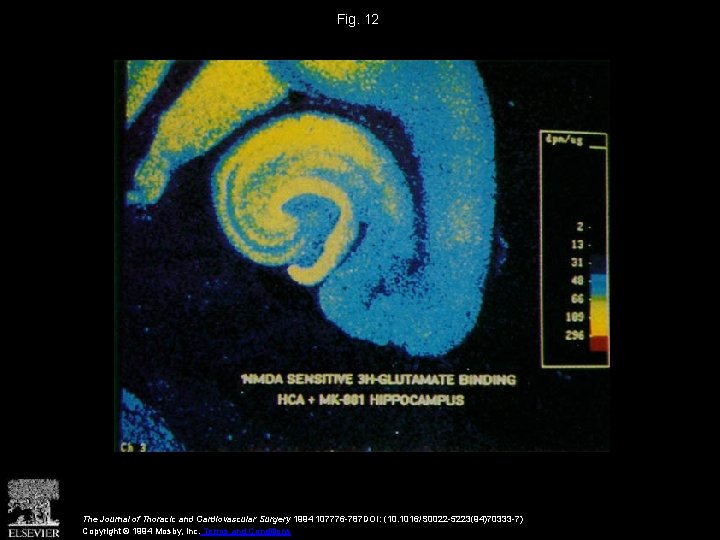 Fig. 12 The Journal of Thoracic and Cardiovascular Surgery 1994 107776 -787 DOI: (10.