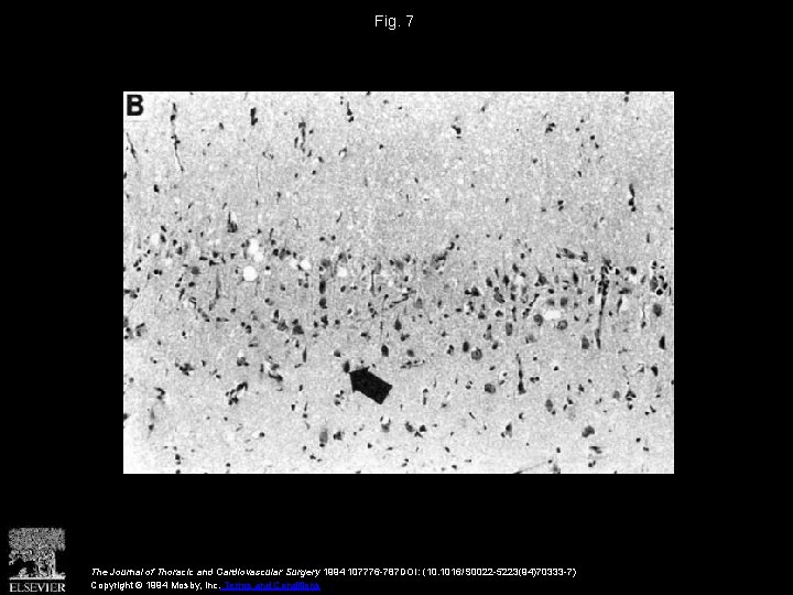 Fig. 7 The Journal of Thoracic and Cardiovascular Surgery 1994 107776 -787 DOI: (10.