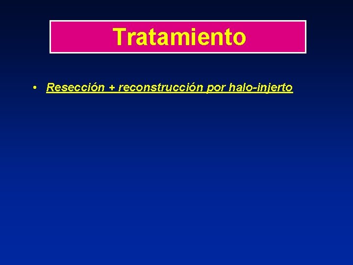 Tratamiento • Resección + reconstrucción por halo-injerto 