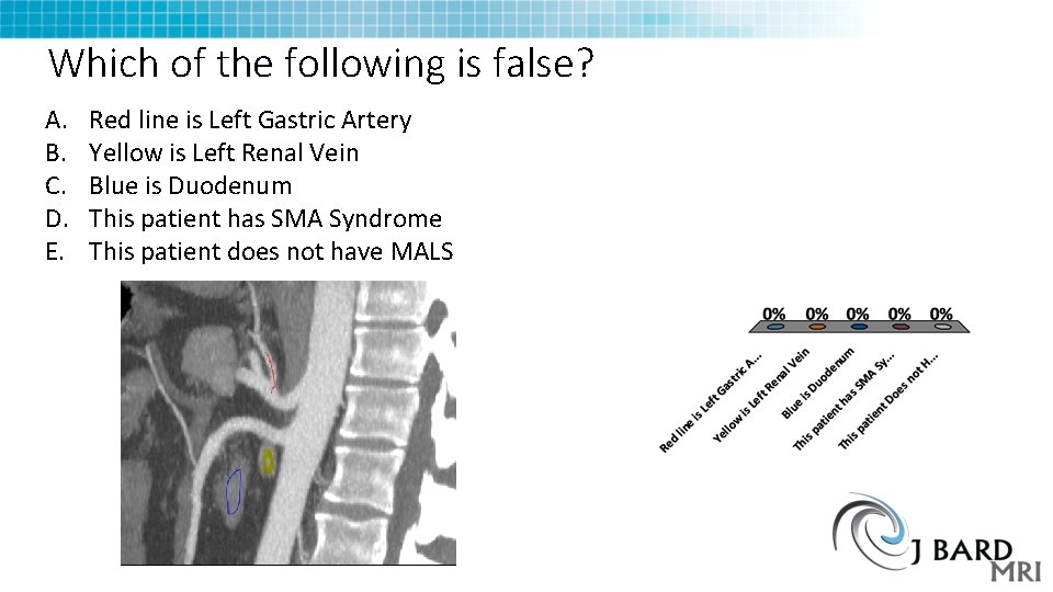 Which of the following is false? A. B. C. D. E. Red line is Which of the following is false? A. B. C. D. E. Red line is