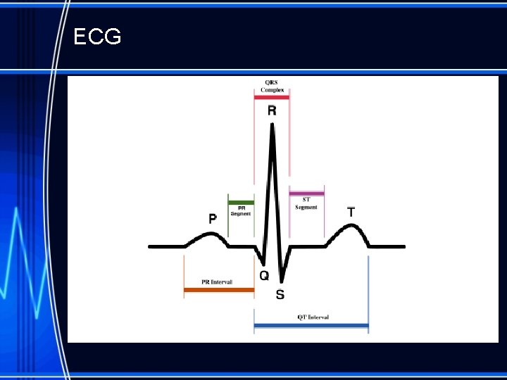 ECG 