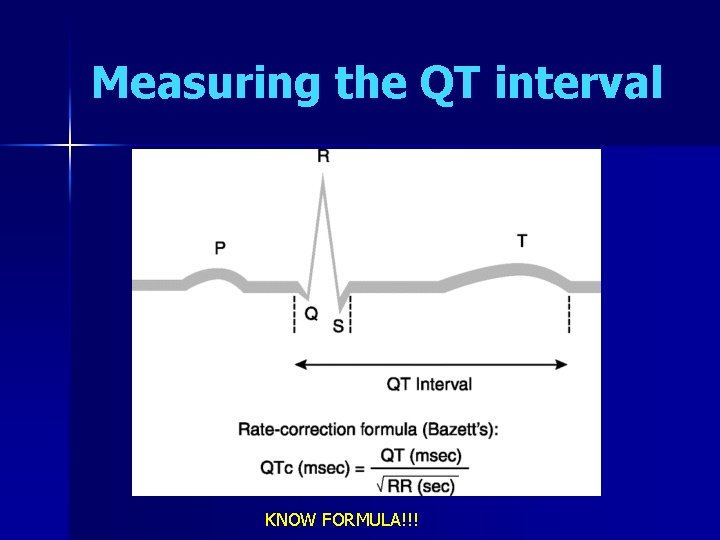 Measuring the QT interval KNOW FORMULA!!! 