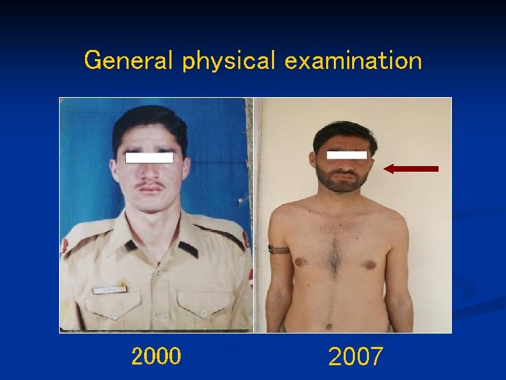 General physical examination 2000 2007 