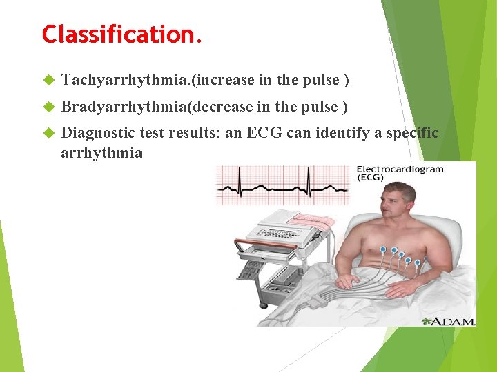 Classification. Tachyarrhythmia. (increase in the pulse ) Bradyarrhythmia(decrease in the pulse ) Diagnostic test