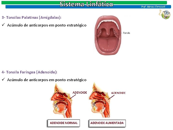 Sistema Linfático 3 - Tonsilas Palatinas (Amígdalas): ü Acúmulo de anticorpos em ponto estratégico