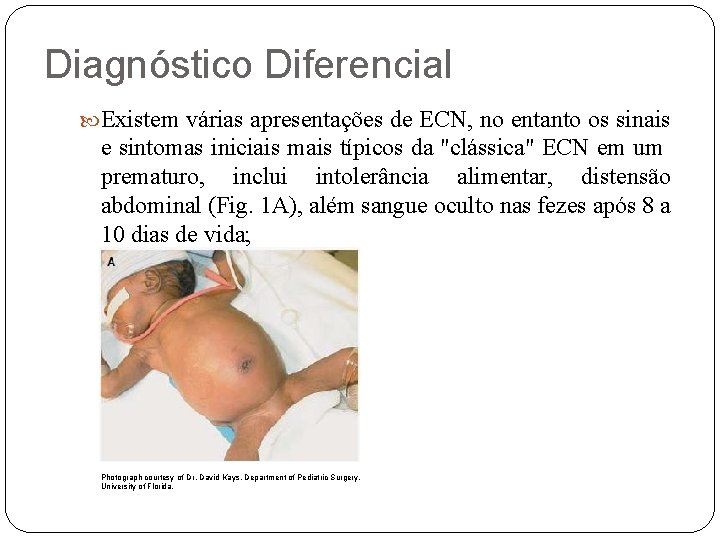 Diagnóstico Diferencial Existem várias apresentações de ECN, no entanto os sinais e sintomas iniciais