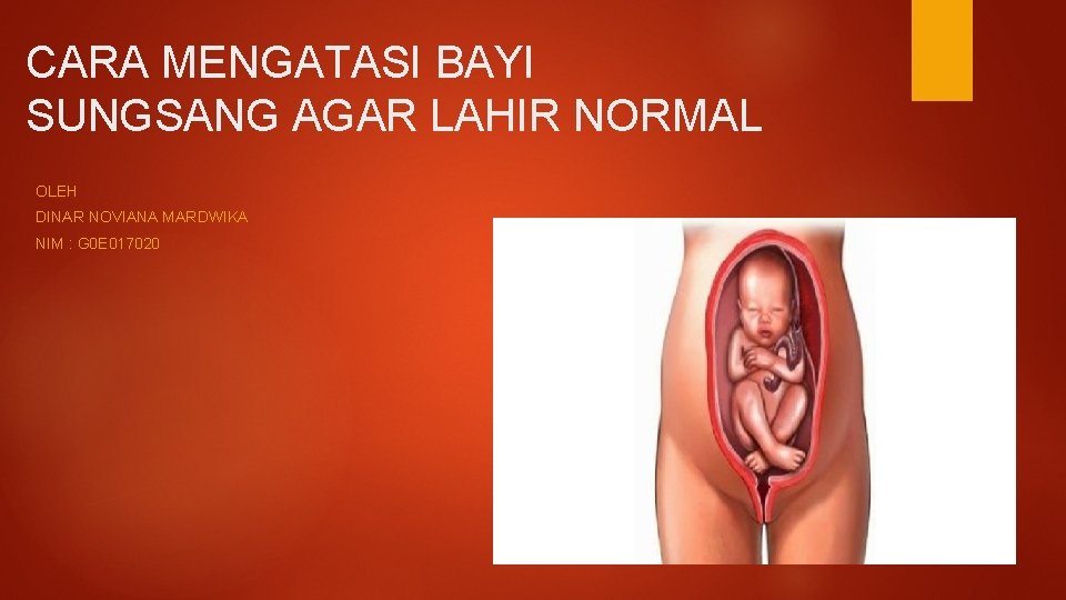 CARA MENGATASI BAYI SUNGSANG AGAR LAHIR NORMAL OLEH DINAR NOVIANA MARDWIKA NIM : G