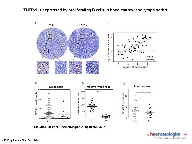 TNFR-1 is expressed by proliferating B cells in bone marrow and lymph nodes. Claudia