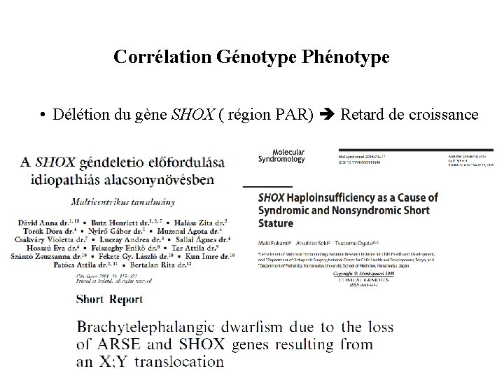 Corrélation Génotype Phénotype • Délétion du gène SHOX ( région PAR) Retard de croissance