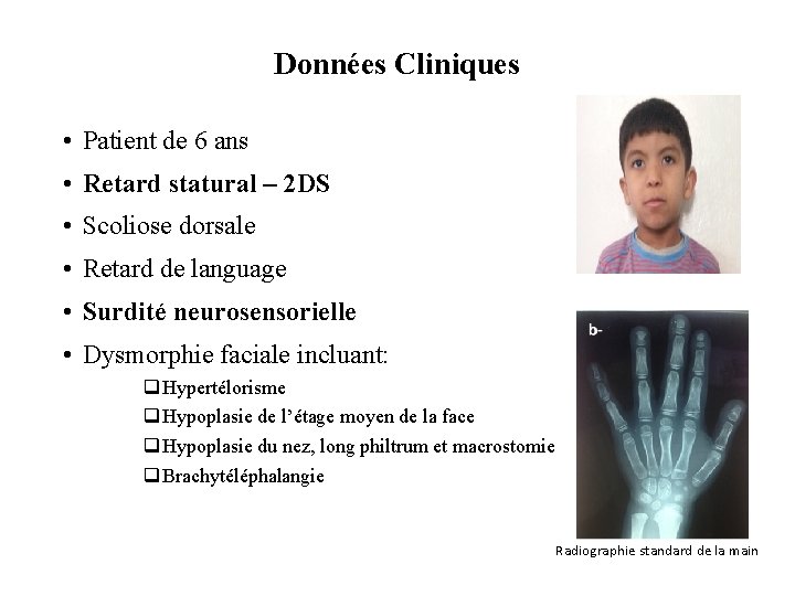 Données Cliniques • Patient de 6 ans • Retard statural – 2 DS •