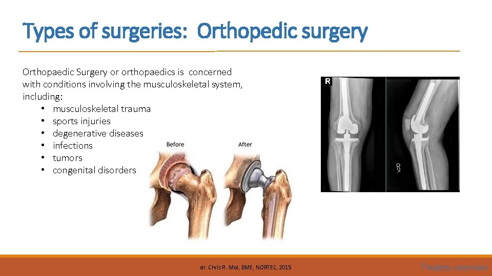 Types of surgeries: Orthopedic surgery Orthopaedic Surgery or orthopaedics is concerned with conditions involving
