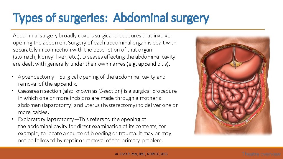 Types of surgeries: Abdominal surgery broadly covers surgical procedures that involve opening the abdomen.