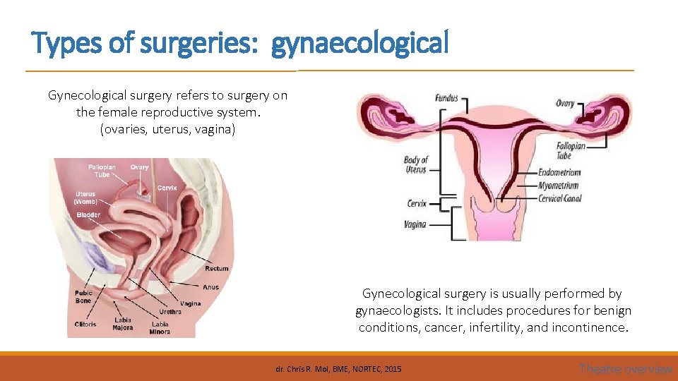 Types of surgeries: gynaecological Gynecological surgery refers to surgery on the female reproductive system.