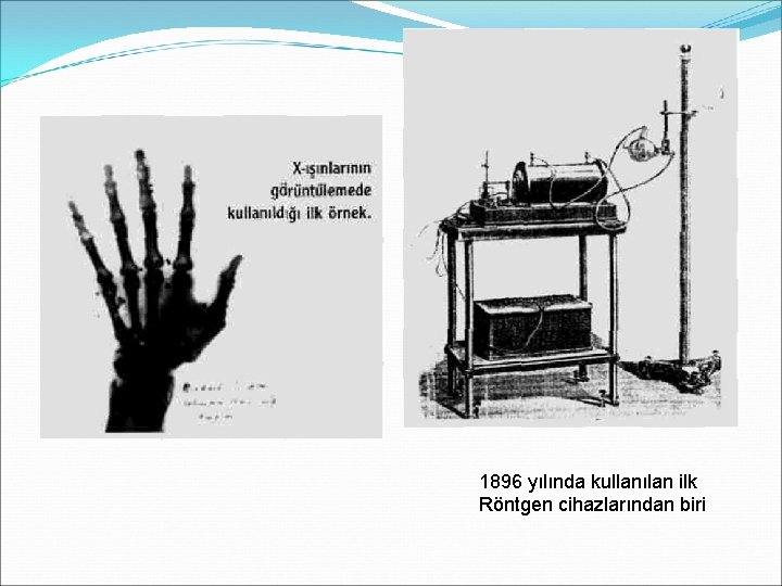 1896 yılında kullanılan ilk Röntgen cihazlarından biri 