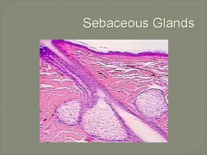 Sebaceous Def Chapter 4 Skin and Body Membranes Objective Checklist