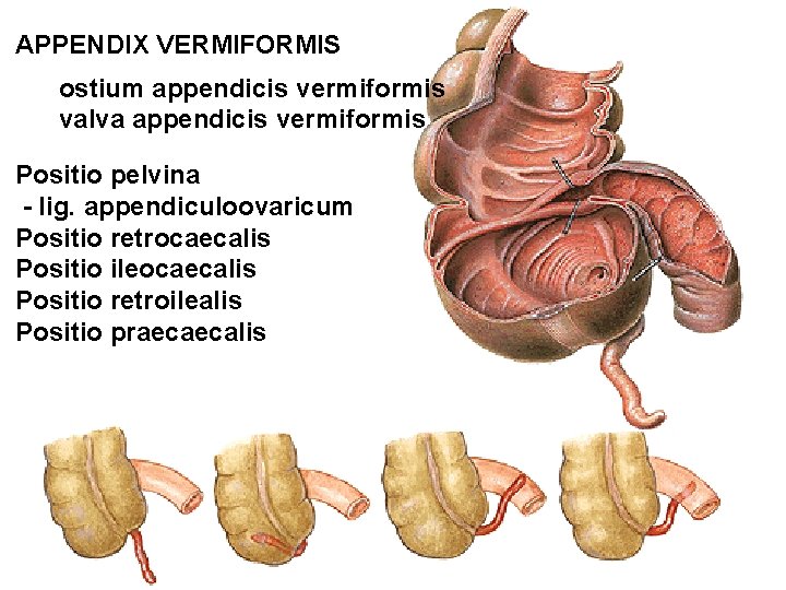 APPENDIX VERMIFORMIS ostium appendicis vermiformis valva appendicis vermiformis Positio pelvina - lig. appendiculoovaricum Positio