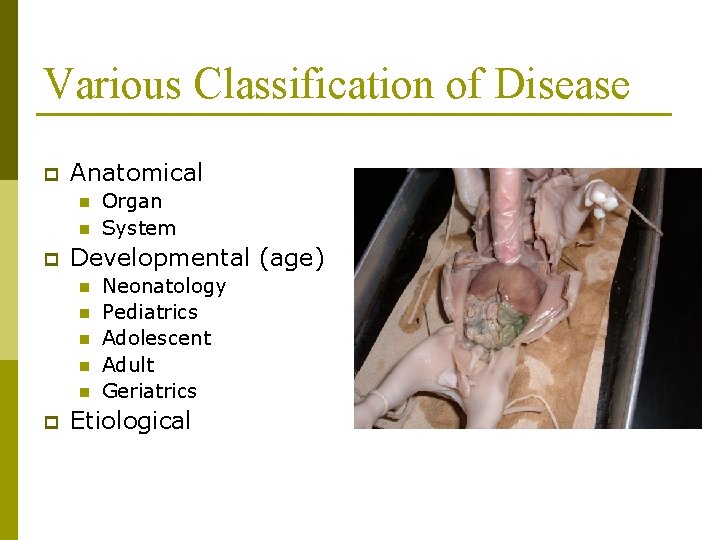 Various Classification of Disease p Anatomical n n p Developmental (age) n n n Various Classification of Disease p Anatomical n n p Developmental (age) n n n