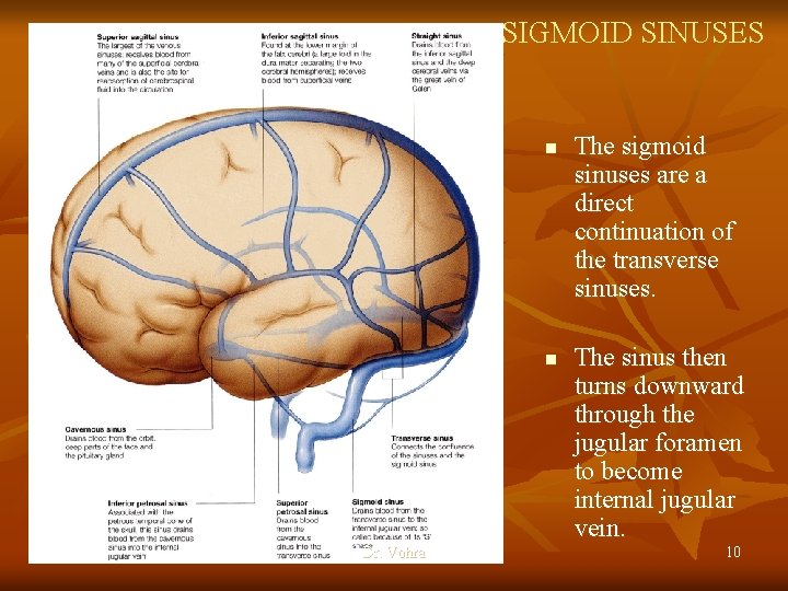 SIGMOID SINUSES n n Dr. Vohra The sigmoid sinuses are a direct continuation of