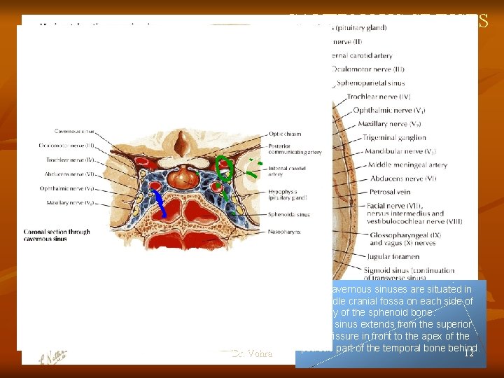 CAVERNOUS SINUSES n n n Dr. Vohra The internal carotid artery, surrounded by its