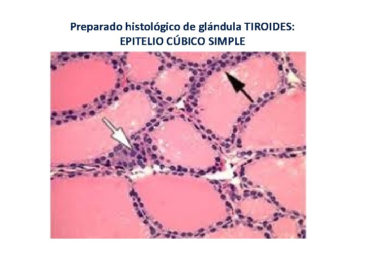 Preparado histológico de glándula TIROIDES: EPITELIO CÚBICO SIMPLE Preparado histológico de glándula TIROIDES: EPITELIO CÚBICO SIMPLE