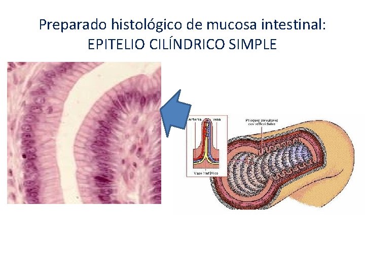 Preparado histológico de mucosa intestinal: EPITELIO CILÍNDRICO SIMPLE Preparado histológico de mucosa intestinal: EPITELIO CILÍNDRICO SIMPLE