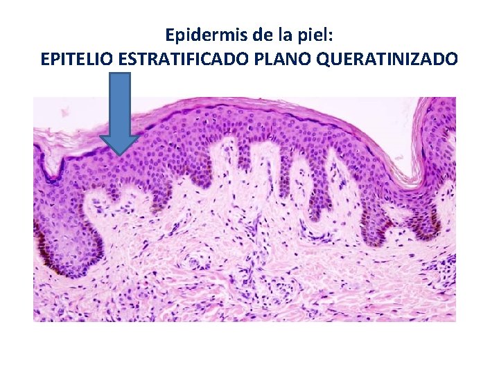 Epidermis de la piel: EPITELIO ESTRATIFICADO PLANO QUERATINIZADO Epidermis de la piel: EPITELIO ESTRATIFICADO PLANO QUERATINIZADO