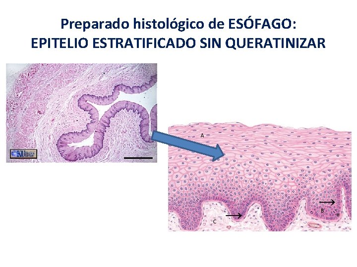 Preparado histológico de ESÓFAGO: EPITELIO ESTRATIFICADO SIN QUERATINIZAR Preparado histológico de ESÓFAGO: EPITELIO ESTRATIFICADO SIN QUERATINIZAR